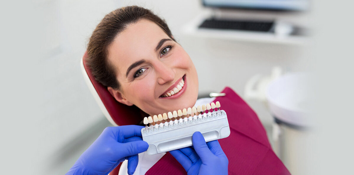 Unlocking the Essentials of Dental Veneers: A Comprehensive Guide