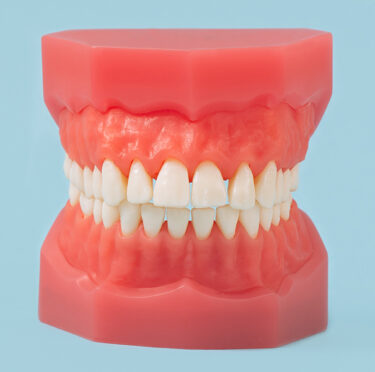 Dentures 101: All You Should Know
